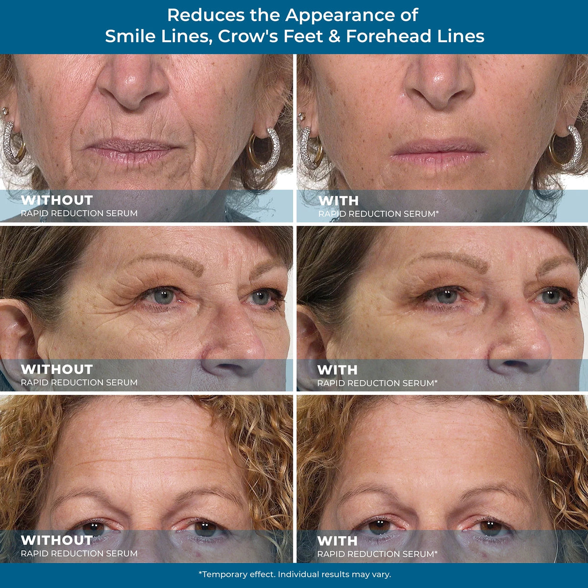 Plexaderm Rapid Reduction Eye Serum cosmetic product image 6